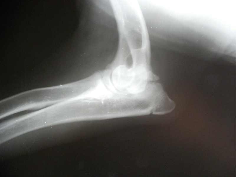 Photo:  An xray of a dog with canine elbow dysplasia.